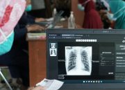 Kenali Kelompok yang Berisiko Tinggi Tertular TBC